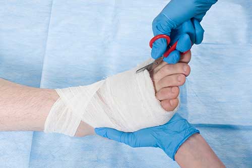 Wound care of bandaged foot Wound care of bandaged foot